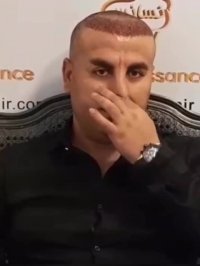 کاشت مو رنسانس