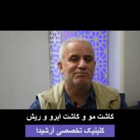 کاشت مو سفید | کلینیک آرشیدا | 02188195746