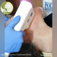 هایفوتراپی