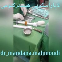 عمل جراحی لاپاراسکوپی هیسترکتومی