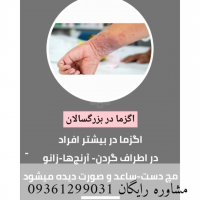 اگر فکر می‌کنی اگزما درمان نداره این کلیپ رو بارها ببین