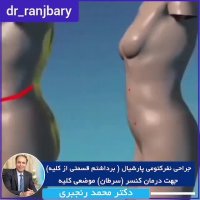 انیمیشن جراحی نفرکتومی پارشیال