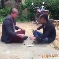 بهترین روش برای کچل کردن افراد