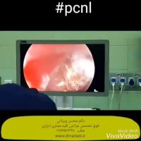 فیلم عمل جراحی آندوسکوپی سنگ کلیه