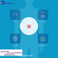 علل و پیشگیری از زخم معده