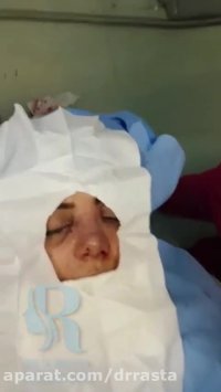 فیلم واقعی جراحی بینی