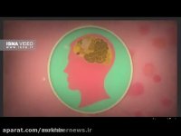 از آلزایمر چه می دانید؟