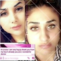 فیلم نمونه کار جراحی بینی