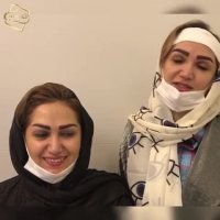 کلینیک کاشت ابرو