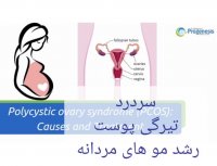 تنبلی تخمدان چگونه باعث نازایی می شود؟