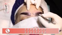 فیلم کاشت ابرو دائمی دکتر فرشته جلالپور