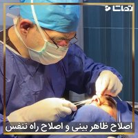 فیلم اصلاح ظاهر بینی و اصلاح راه تنفس
