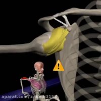 آرنولدشو.آموزش  حرکت پشت بازو در بدنسازی