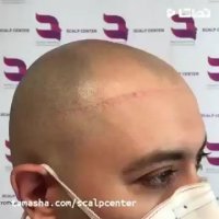 اسکالپ اسپرت