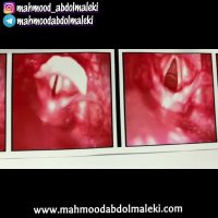 آموزش آواز - صداسازی - آموزش نحوه درست صحبت کردن و بهبود صدای هنرجوی کلاس آنلاین صداسازی