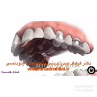 بهترین متخصص ارتودنسی