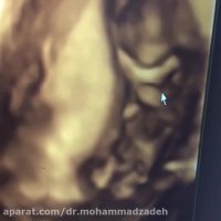 احساس مادر هنگام سونوگرافی