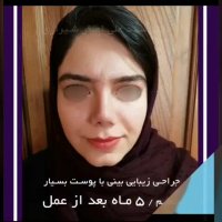 فیلم واقعی جراحی بینی گوشتی