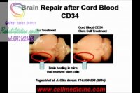 برترین و تخصصی ترین مرکز توانبخشی در کرج|گفتار توان گستر البرز 09121623463