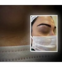 فیلم نمونه واقعی کاشت ابروی طبیعی