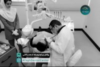 روکش زیرکونیا دندان