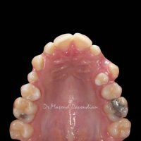 دکتر ارتودنسی | دکتر داوودیان