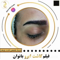 کاشت ابرو طبیعی | کلینیک آیتک | 44221324-021