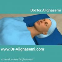 جراحی زیبایی پلک 4