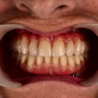 زیبایی دندان-دکترمجیدقیاسی دندانپزشک زیبایی مشهد