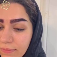 فیلم کاشت ابرو کلینیک تخصصی رنسانس