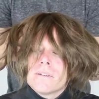 کاشت مو حرفه ای برای آقایون به این میگن!