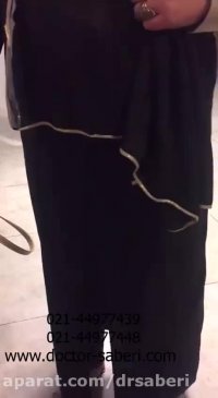 فیلم پنج ماه بعد از عمل شکستگی پیچیده لگن