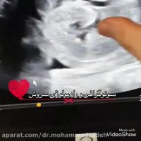 فیلم سونوگرافی شکم جنین