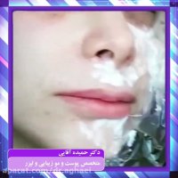 فیلم کربوکسی تراپی زیرچشم