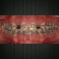 ارتودنسی تهران | دکتر داوودیان