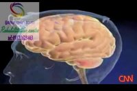 برترین مراکز توانبخشی کودکان و بزرگسالان کرج|گفتار توان گستر البرز09121623463