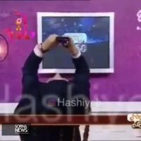 ژیلا صادقی و اینبار انتقاد از عمل بینی