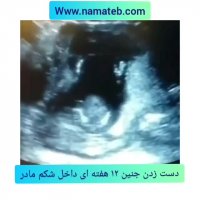 دست زدن جنین 12 هفته ای داخل شکم مادر