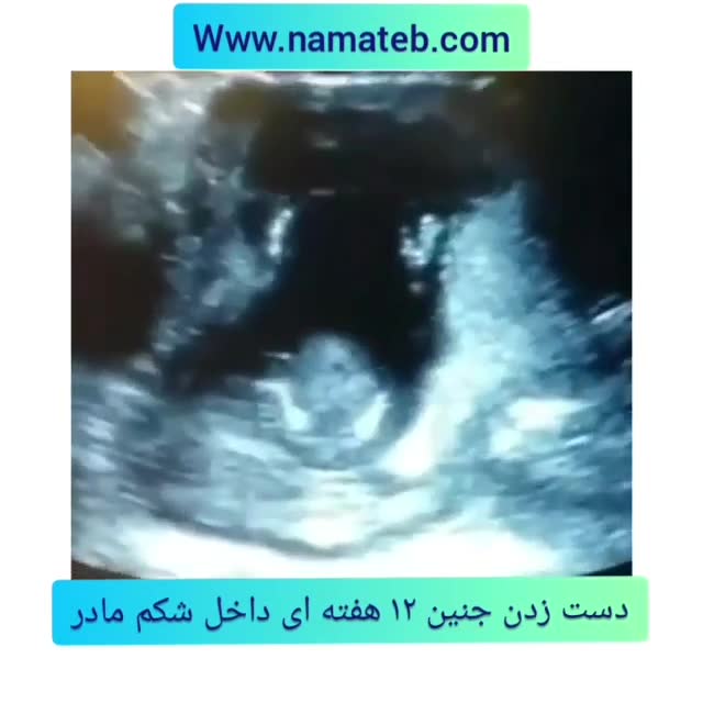 حرکت جنین در شکم تماشا