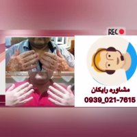 پیسی خفیف و راهکار های درمانی