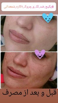 کرم ضد لک و چروک 8 کاره شمعدانی سفارش واتساپ09356341118