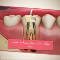 قبل از اینکه دندانتان درد بگیرد به دندانپزشکی مراجعه کنید!!!