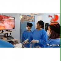 مینی بای پس خانم 39 ساله