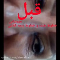 آموزش مجازی حضوری و انجام مزوتراپی موسسه ایران زمین