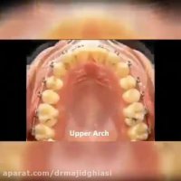 ارتودنسی دندان مشهد-دکترمجیدقیاسی جراح ودندانپزشک زیبایی