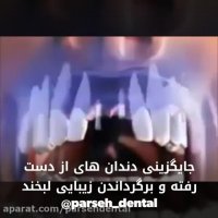 جایگزین دندانهای از دست رفته