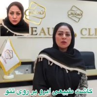 فیلم کاشت ابرو - کلینیک تخصصی رنسانس