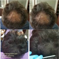 Dr.Ayromlou Scalp Center