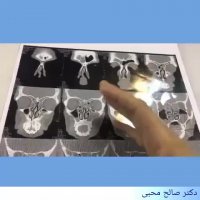 آموزش و آشنایی با سی تی اسکن