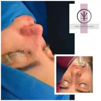 فیلم واقعی جراحی بینی